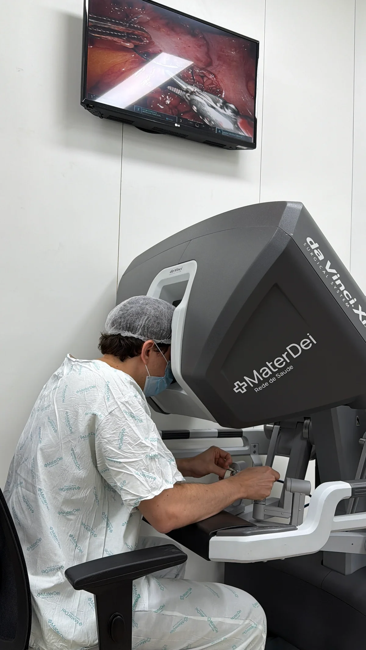 Dr. Matheus Massahud operando o console de um sistema de cirurgia robótica, com o procedimento exibido no monitor.